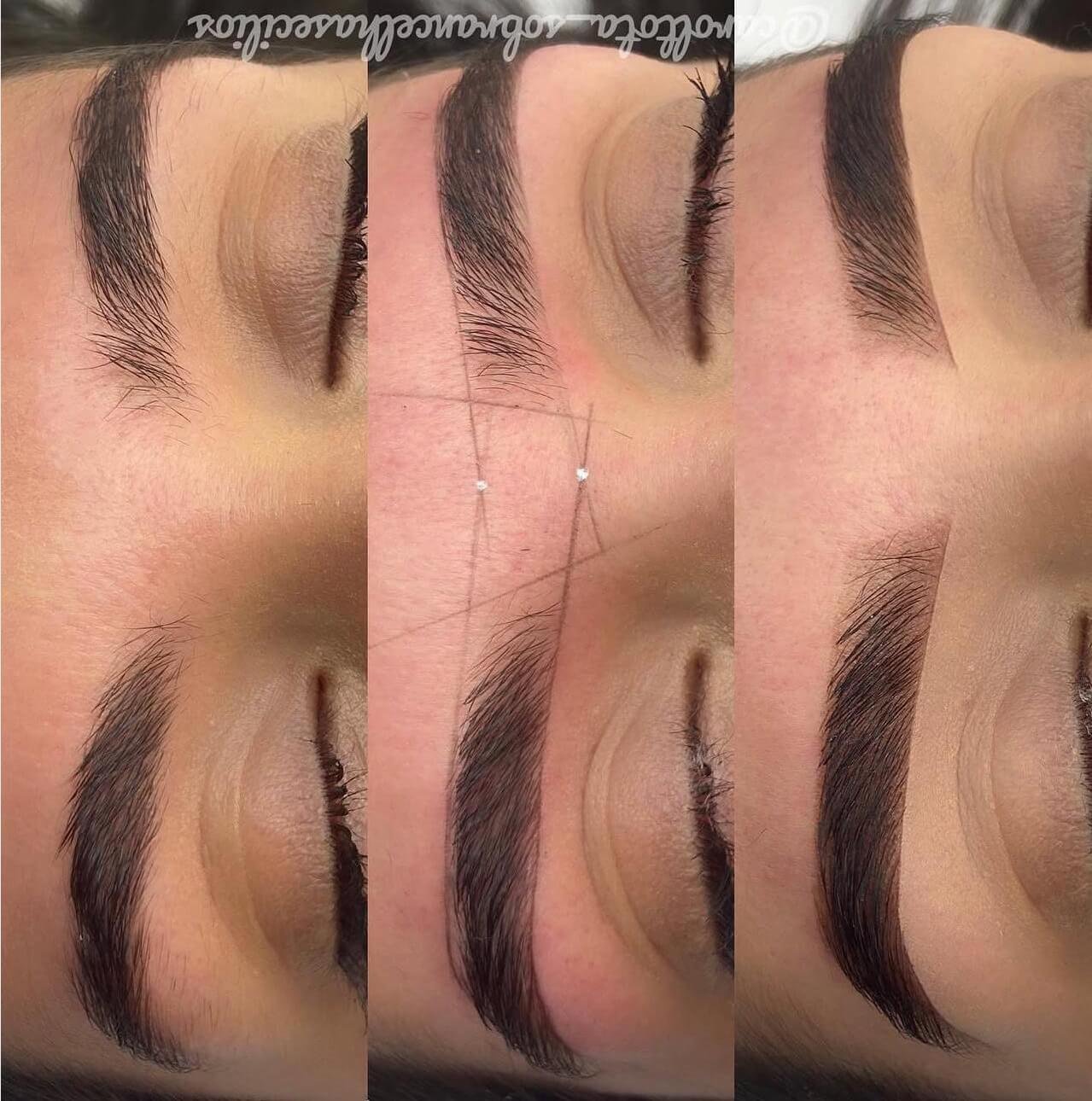 Carol Tota Procedimento 3